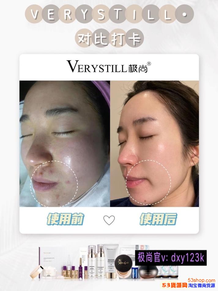 管家婆三肖三码大全免费与新奥今天晚上必开一肖:真正的效果如何;影响深远的决策、值得解释落实