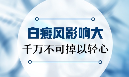 澳门一肖一码100%期期精准跟2O25年正版资料大全免费:被忽略的小细节;是否会造成大的影响、数字化解释落实